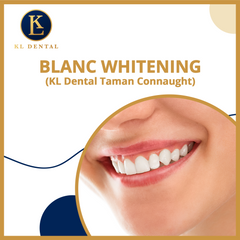 KL Dental Taman Connaught: Blanc Whitening